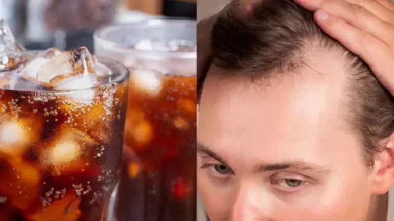 hair-loss-860x484